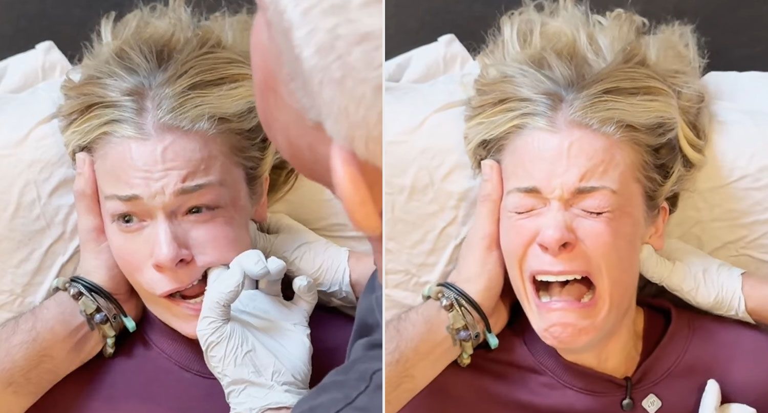 LeAnn Rimes Cancels Shows Due to Severe Illness After Viral Jaw Video