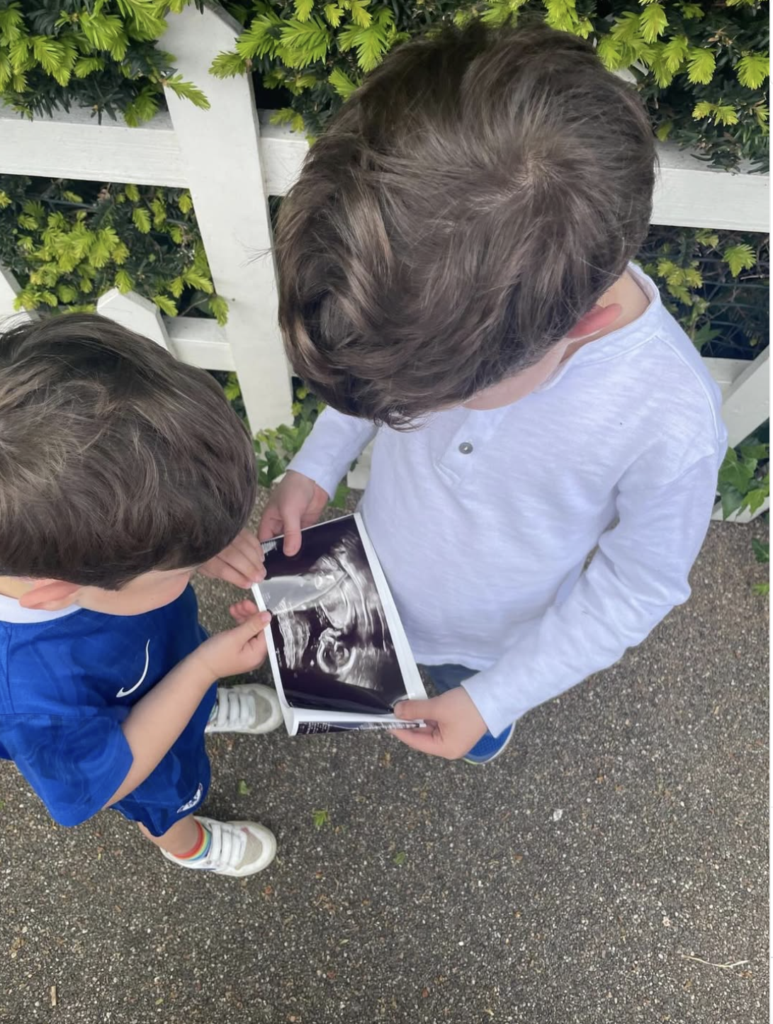 Princess Eugenie Expecting Third Child as King Charles Expresses Delight